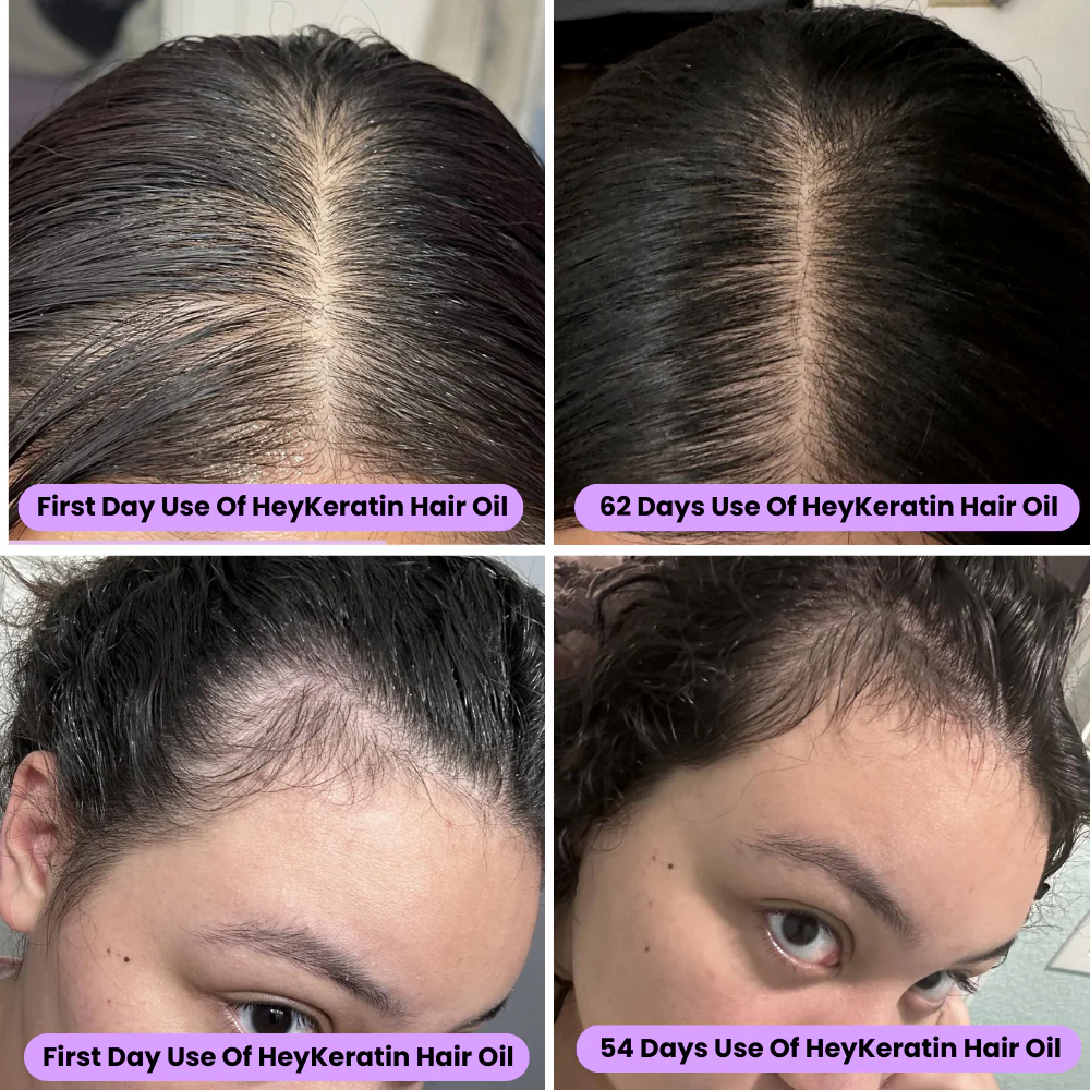 Elveur Natural Hair Growth Oil