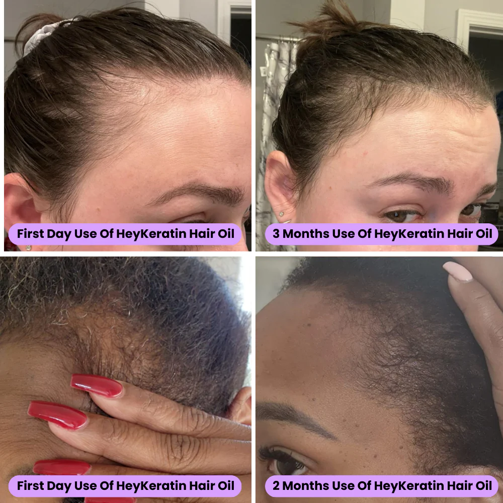 Elveur Natural Hair Growth Oil